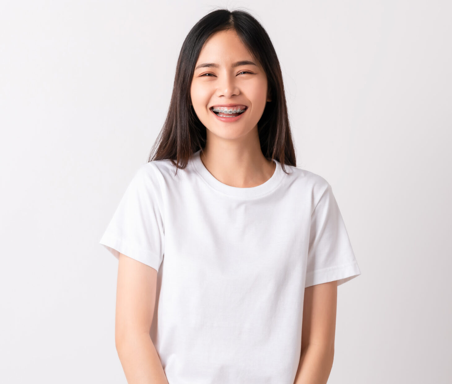 Studio shot of cheerful beautiful Asian woman in white t-shirt and stand smiling with braces on white background.